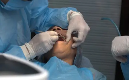 Is It Painful to Get Dental Implants?